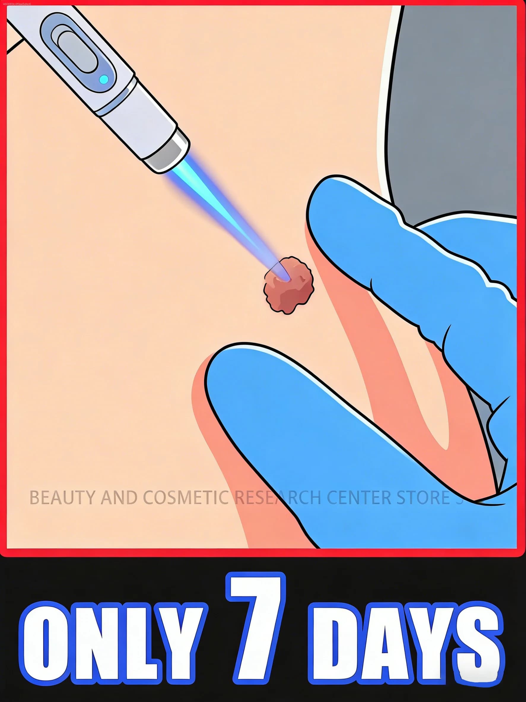 2026 Professional and safe blue ʟɪɢʜᴛ causes natural ᴅᴇᴛᴀᴄʜᴍᴇɴᴛ, painless and without leaving any trace.